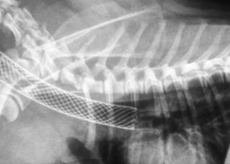 Stent traqueal no colapso de traqueia: quando indicar?